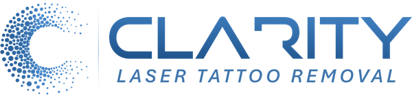 Clarity Tattoo Removal