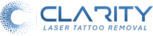 Clarity Laser Tattoo Removal